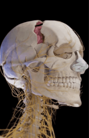 Craniosynostosis: Cranial Remodeling and Early Intervention